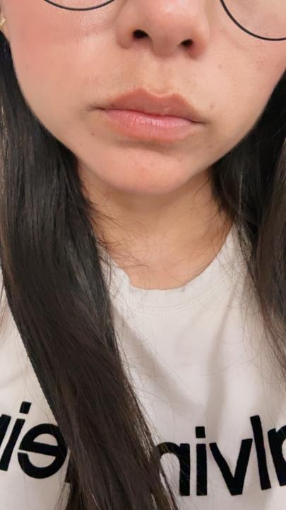 Img-perfil